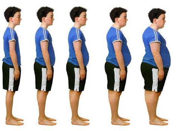 The United States of Obesity [Infographic]